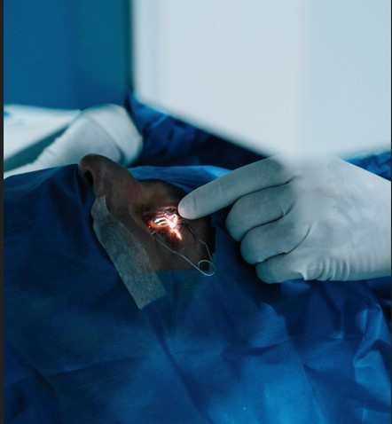 Futuristic laser eye surgery showcasing advanced vision correction technology