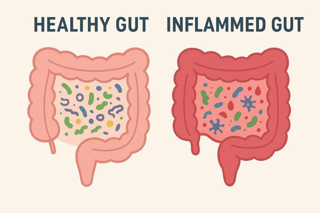 Visual comparison of a healthy gut lining with diverse flora and an inflamed, permeable "leaky gut," illustrating the root cause of systemic inflammation in the Gut Eye Axis.