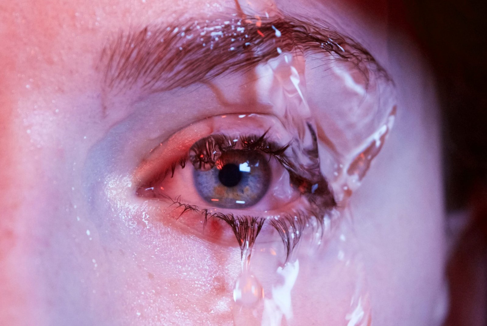 Eyes watering but feel dry in a close-up of a watery eye